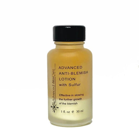 ASC Advanced Anti-Blemish Lotion 1 fl oz (30 ml) - Advanced Skin Care Day Spa - Advanced Skin Care